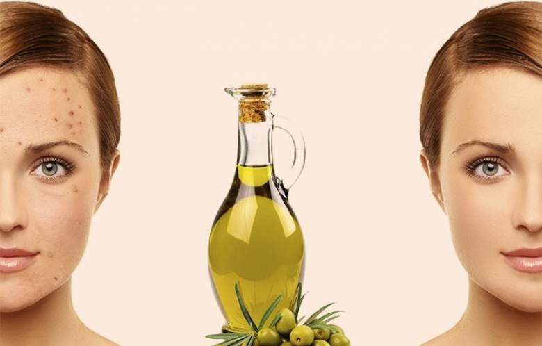 6 alternative uses of Extra Virgin Olive Oil 3 come eliminare acne olio oliva - La Marronaia - extra virgin olive oil